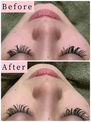 ハーブピーリング専門 muro.のエステ・リラクイメージ