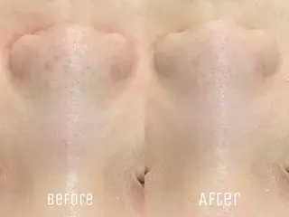 ニキビ・毛穴・肌荒れ &me 西宮北口店のその他イメージ