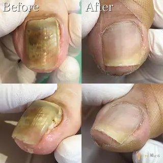 巻き爪補正店　福山店所属・巻き爪補正店 福山店のエステ・リラクイメージ