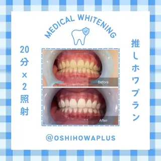 Belle plus 江坂店所属・ホワイトニング/肌管 Belle plusのその他イメージ