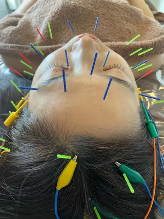 美容鍼灸サロン mahoroba院長のエステ・リラクイメージ