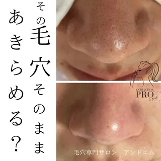 &. mのマツエク・マツパデザイン