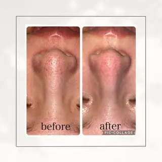 シミ・毛穴専門店 gracia 宇土店所属・シミ・毛穴専門店 /gracia 安藤のエステ・リラクイメージ