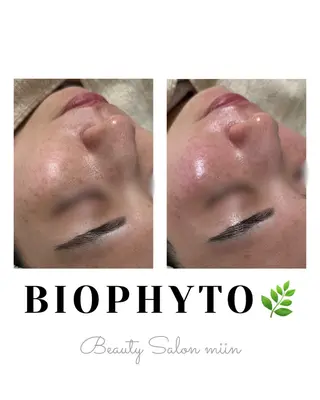 韓国肌管理 白玉肌管理®︎のエステ・リラクイメージ