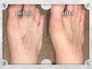 都度払い 脱毛 Lino柏/moeのエステ・リラクイメージ