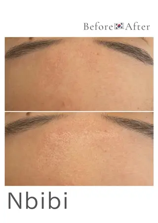 韓国🇰🇷価格 サロン_Nbibiのエステ・リラクイメージ