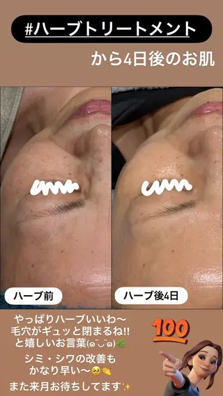 LiZA エステティックサロンのエステ・リラクイメージ