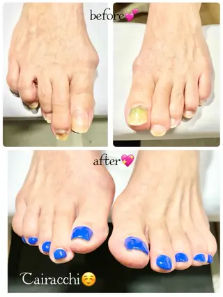 ネイル Tairacchi ﾀｲﾗｯﾁのエステ・リラクイメージ