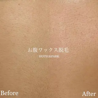 HOTEL&PARK . ワックス脱毛のエステ・リラクイメージ