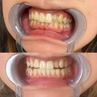 R E O T I A R A（レオティアラ）所属・高屋 昌子のその他イメージ