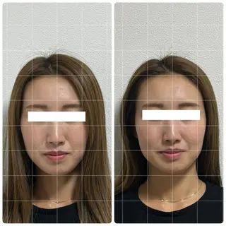 くつろぎ小顔サロン Lu mellow所属・片山けいこ｜ 美人顔創りの専門家のエステ・リラクイメージ