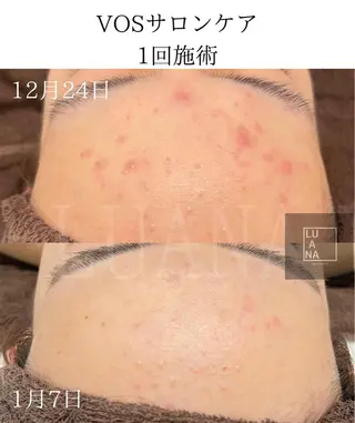 LUANA TAKAGIの眉毛・アイブロウイメージ