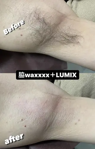 メンズ Epina 千葉店 【エピナ】のエステ・リラクイメージ