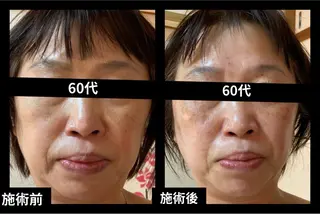 夜エステサロン🌷Luana所属・夜サロン♡ Luana🦋.*˚のエステ・リラクイメージ