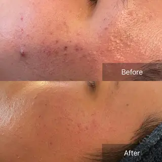 美楽鍼 びらくしんのその他イメージ