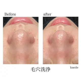 🎀kaede🎀 骨格似合わせ眉毛の眉毛・アイブロウイメージ