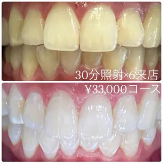 PLATINUM Beauty 横浜店所属・ホワイトニングルーム 横浜店のその他イメージ