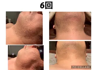 Feather TOMのエステ・リラクイメージ