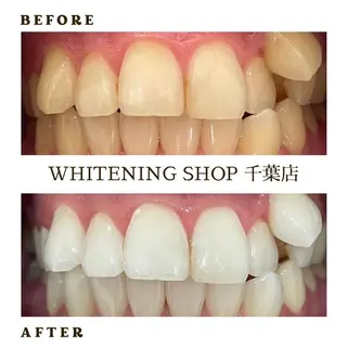 メンズ ホワイトニング ショップ千葉店のその他イメージ