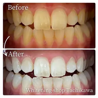 セルフ ホワイト ニングショップ立川のその他イメージ