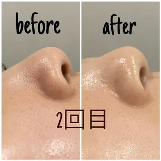 アルカンジュ~archange~所属・痩身/毛穴洗浄/脱毛 アルカンジュのエステ・リラクイメージ