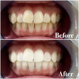 ロング カラー パーマ ヘアアレンジ メンズ キッズ ネイル マツエク・マツパ ライトビューティー 錦糸町店のエステ・リラクイメージ