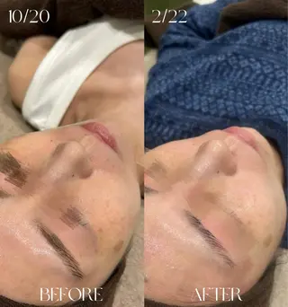 美容革命ラボ福岡春吉店所属・美容革命ラボ 福岡のエステ・リラクイメージ