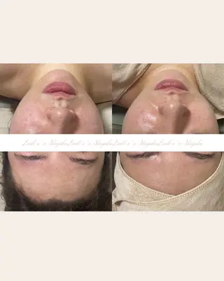 美腸サロン🌺 腸もみ/小顔/リンパのエステ・リラクイメージ