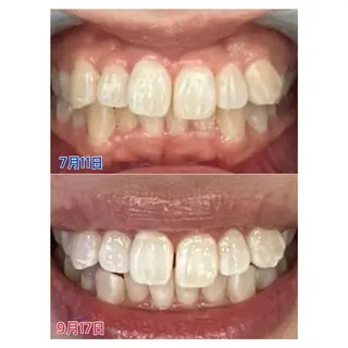 MBEAUTYSALON 千葉店・京成大久保所属・Melty 輝のその他イメージ