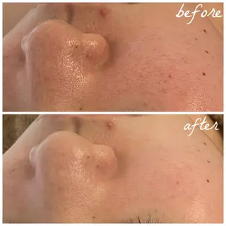 メンズ メナード岐阜茜部 杉浦のエステ・リラクイメージ