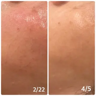 メナード片町 やまもと みくのエステ・リラクイメージ