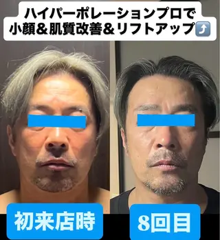 メンズ salon de blue rose所属・ハイパーナイフ専門 熊田陽子のエステ・リラクイメージ