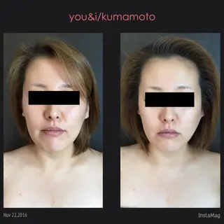 キッズ マツエク・マツパ You&i(ユーアイ)所属・Nomura Suuのエステ・リラクイメージ