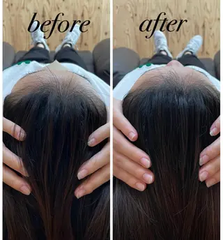 ate'所属・個室ドライヘッドスパ 🍃moriのエステ・リラクイメージ