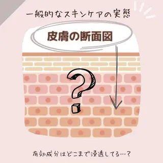 ニキビ特化型エステ 🍓最短で肌質改善のエステ・リラクイメージ