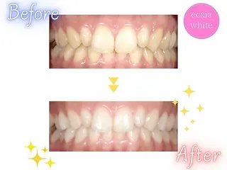 セルフホワイトニング エクシア五反田店のその他イメージ