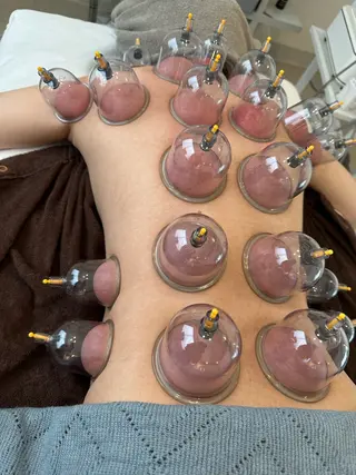 ハイフ&ドライヘッドスパ　SLIVIA所属・SLIVIA 毛穴洗浄&ヘッドスパのエステ・リラクイメージ