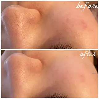 メンズ メナード岐阜市茜部 杉浦のエステ・リラクイメージ