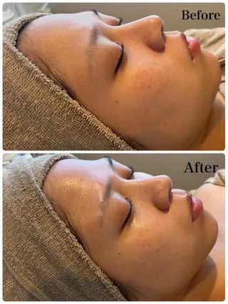 MISEL  2nd所属・主島 葉月のエステ・リラクイメージ