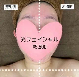 RE:moom リムーム/脱毛エステのエステ・リラクイメージ