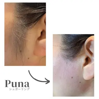 ぷーな シュガーリング竹ノ塚のエステ・リラクイメージ