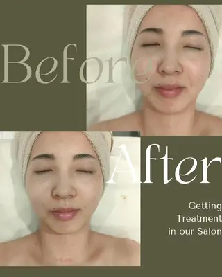 美肌脱毛＆小顔・フェ イシャル【SONA】のエステ・リラクイメージ