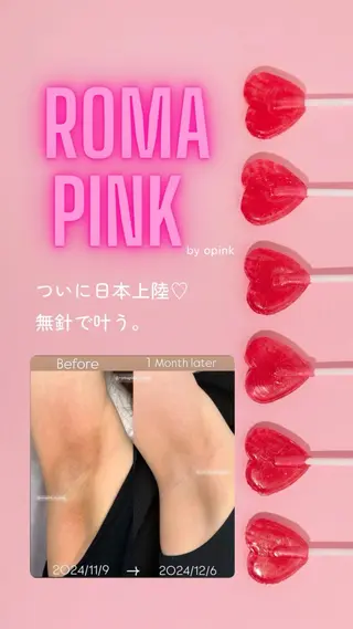 Monreve所属・美人スイッチdiet スーパージェクションのその他イメージ