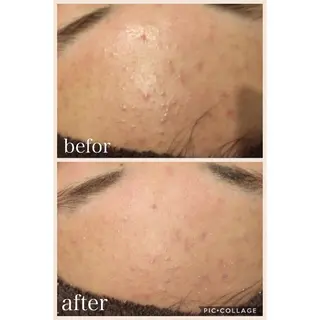 ショート ニキビ跡専門サロン Ａｉｎａのエステ・リラクイメージ