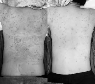 四つ星サロン🎖 腸＆ニキビケアに特化のエステ・リラクイメージ