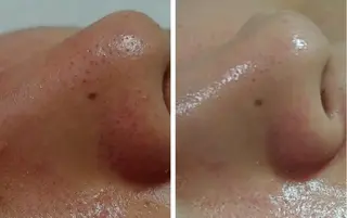 あんみっこ kitaのエステ・リラクイメージ