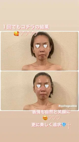 コルギサロンHonon所属・コルギサロン Hononのエステ・リラクイメージ