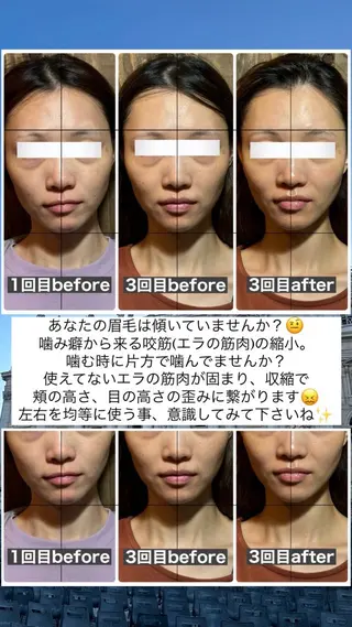 💎後悔させない小顔 矯正💎イトヤマ🌱のエステ・リラクイメージ