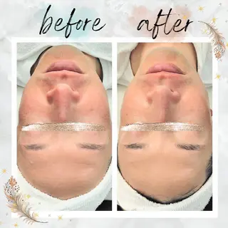 NARIS beautysalon 所属・Takahashi  Hiromiのエステ・リラクイメージ