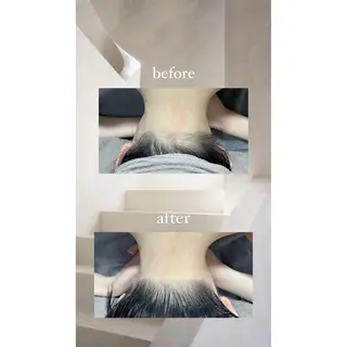 crescent所属・【韓国肌管理・脱毛】 クレセントのその他イメージ